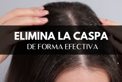 Cómo eliminar la caspa de forma efectiva